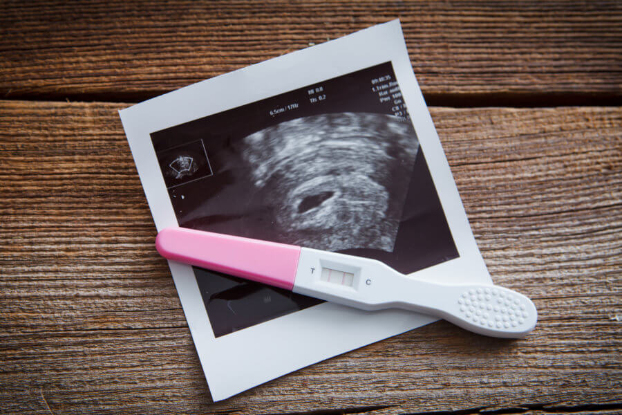 positive pregnany test and a sonogram