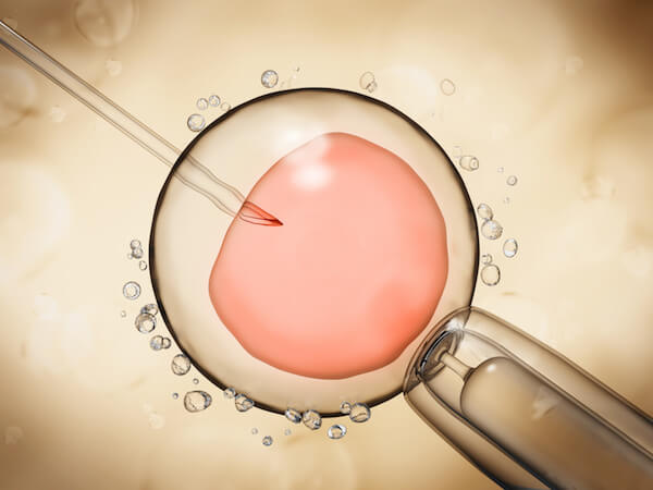 Artificial insemination illustration showing the ovule on yellow background