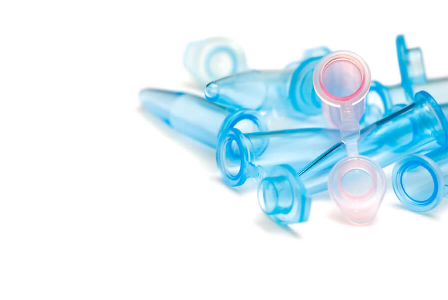 Lab tests common to the fertility diagnosis process