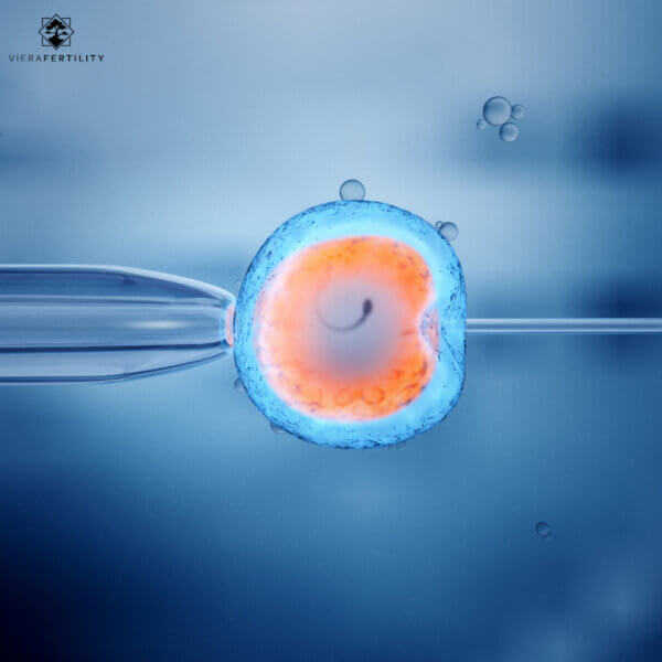 In Vitro Fertilization